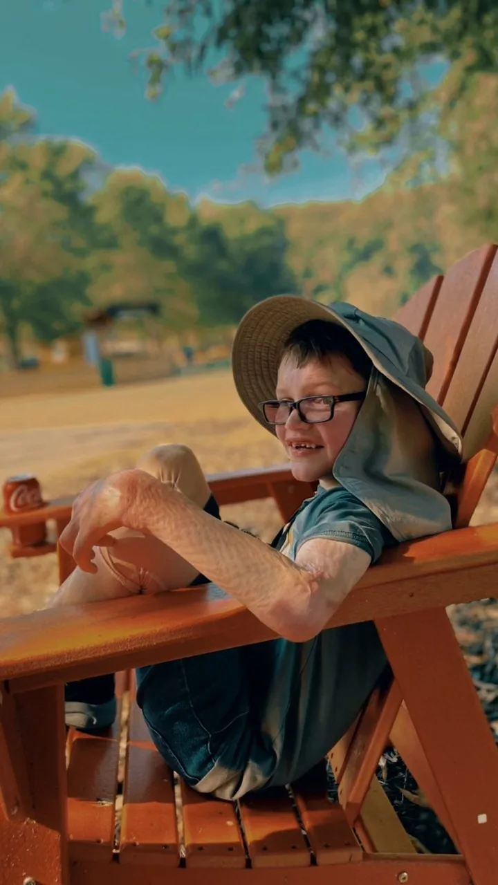 Georgia Firefighters Burn Foundation ad: a young burn survivor in a sun hat smiles from a camp chair at summer camp.